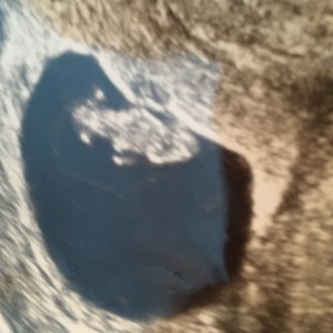 Katy Pearson, scan photo, seven week scan, Sonny Jim, #whatkatydidUK